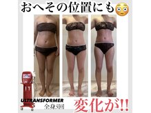 痩身の概念を覆したウルトランスフォーマー