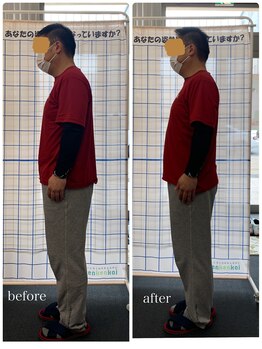 ビーメイク(Be make)/初回施術before&after