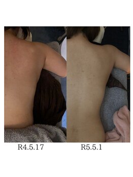 ネコロビヤ(Necorobi家)/リンパを流してダイエット成功！