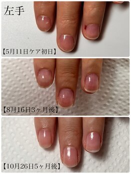 トイロ ネイル(Toiro Nail)/◇HAND◇クイックケア