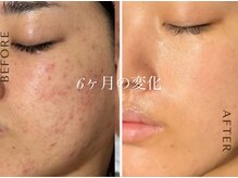 オーシャンブルーム 目黒(OceanBloom)/【スタッフ変化】アンストレス