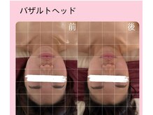 ラドゥサー(La douceur)/