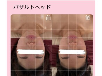 ラドゥサー(La douceur)/