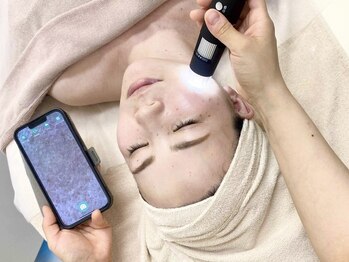 クリアプラス(Clear+)の写真/【肌を改善したい方必見！】★毛穴洗浄とお肌のお悩みに合わせたパックで毛穴・くすみ・ニキビケア★