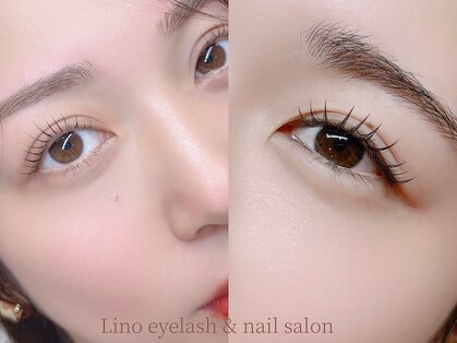 リノ(Lino)の写真