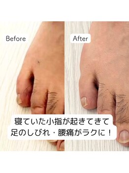 はやと整体院/70代男性(足のしびれ)