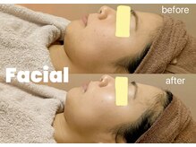 人気★ヘッドスパ付きフェイシャルエステ♪透明感&リフトアップ