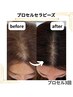 薄くなるかも...頭皮の不安・抜け毛予防・頭皮 悩みに★当日施術¥40,000