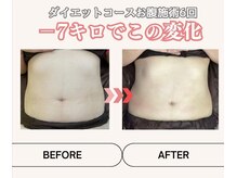 MBF整体/－７キロでこの変化