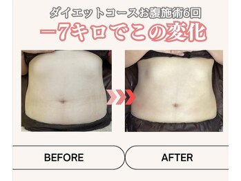 MBF整体/-7キロでこの変化