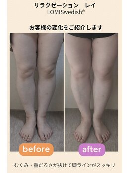 レイ(Lei)/お客様の変化