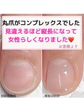 ミミ(mimi)/丸爪が縦長の爪になりました！