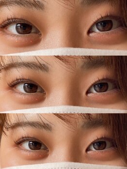 ビューティーアミューズメント 山鼻店(BEAUTY AMUSEMENT)/1月岩切