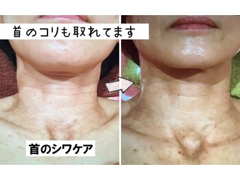 ビューティースパ/首のシワケア/肩首コリもお任せ
