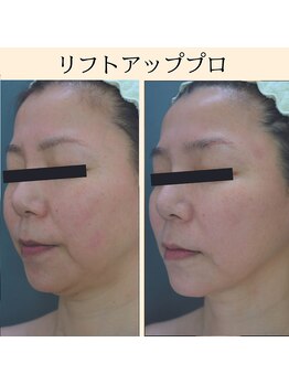 オレンジバナナ 長岡アクロスプラザ店/【リフトアッププロ】