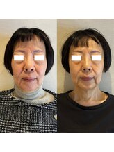 ラドンナ(LA DONNA)/韓国Oracle美容皮膚科提携機器