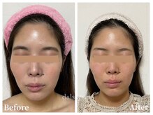 ダルセーニョ/お目元を隠しても伝わります♪