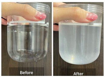 ステッラ(STELLA☆)/毛穴洗浄　Before/After