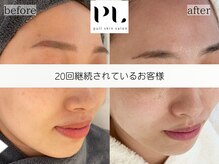 プルスキンサロン 大阪店(pull skin salon)/