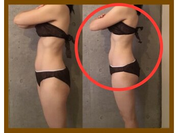 サロンドボーテ ヴィクトワール マルヤマ(Salon de beaute VICTOIRE MARUYAMA)/痩身ならおまかせください!