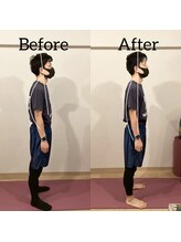 おこしんちゅ 渋谷 代々木公園/施術前後の写真です