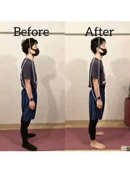 おこしんちゅ 渋谷 代々木公園/施術前後の写真です