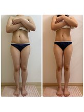 加圧ビューティーサロン スタイル エム(beauty salon style M)/20代/加圧×痩身リンパ70分