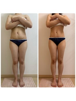 加圧ビューティーサロン スタイル エム(beauty salon style M)/20代/加圧×痩身リンパ70分