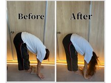 整体ラルース 中目黒(LALUZ)/20代　女性　腰痛、反り腰改善