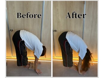 整体ラルース 中目黒(LALUZ)/20代 女性 腰痛、反り腰改善