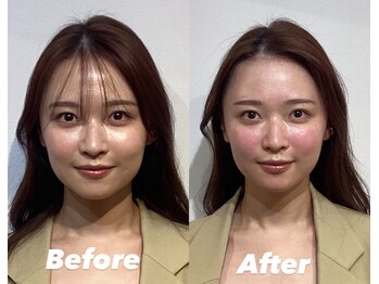 コルミチョン サロン(骨美整 salon)/Before・After