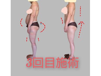 オーガニックサロン ポアン(Poan)/夏までには痩せる!!