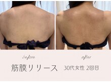 アールエスト(R EST.)/筋膜リリース×肩甲骨はがし☆