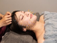 ルルハリ(LuluHari)/美容鍼が初めての方にも♪