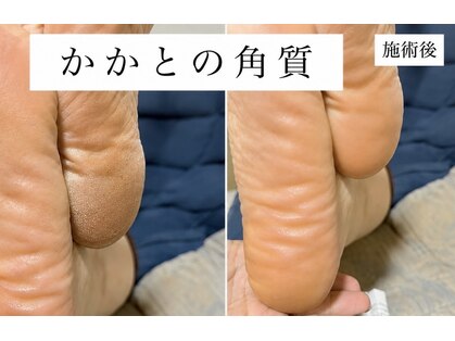 レジーナネイル(Reginanail)の写真