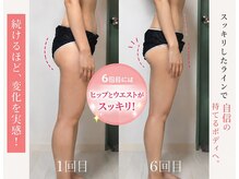 ボルテージ マーキュリー 湯島本郷店(Voltage Mercury)の雰囲気（【上質空間】アットホームな雰囲気とおしゃれな運域でダイエット）