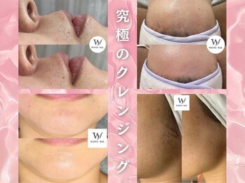 ホワイトワックス 新潟万代店(WHITE WAX)/究極の毛穴クレンジング