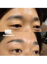 レビー(Revie)/HBL