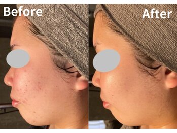 サロン デ ミロ(Salon de Miro)/BeforeAfter多数！ブログへGO♪