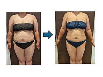 ローブメール(Robemail)/ビフォーアフター