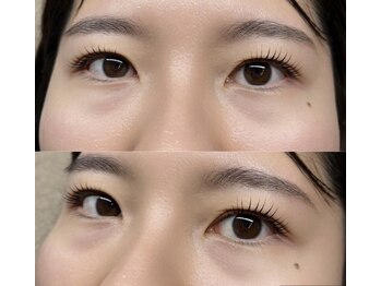 ラリュール(L'Allure)/【パリジェンヌラッシュリフト】