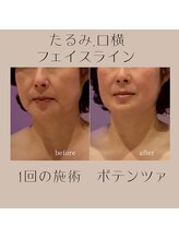 ナナイロ(nanairo)/