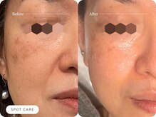 キュレイテッドスキン(CURATED SKIN)/