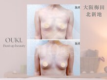 【育乳・バスト専門×女性らしさを磨く】OUKI. 梅田北新地【3月1日 OPEN（予定）】/バスト結果写真