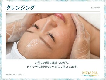 モアナ(MOANA)/【小顔/たるみ】インモード