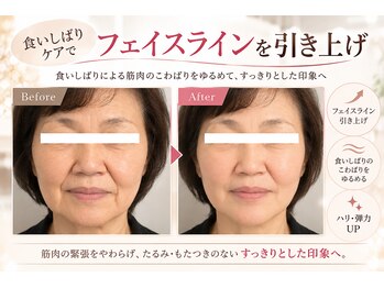 ラシクビューティールームの写真/食いしばり・顎下・フェイスラインが気になる方へ。大人の小顔ケア