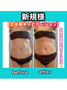 ビューティ ウィッチ(Beauty Witch)/