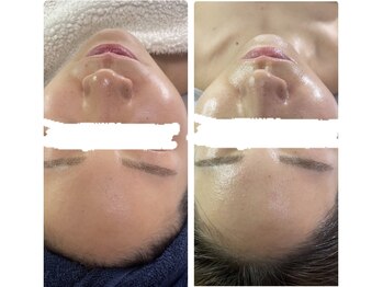 カラ(CARA)/韓国人気No,1肌管理♪ララピール