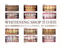 ホワイトニングショップ 広島廿日市店