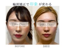 プルチャームエクイデム(Pulchram equidem)/ヘッドスパ+小顔矯正+機械